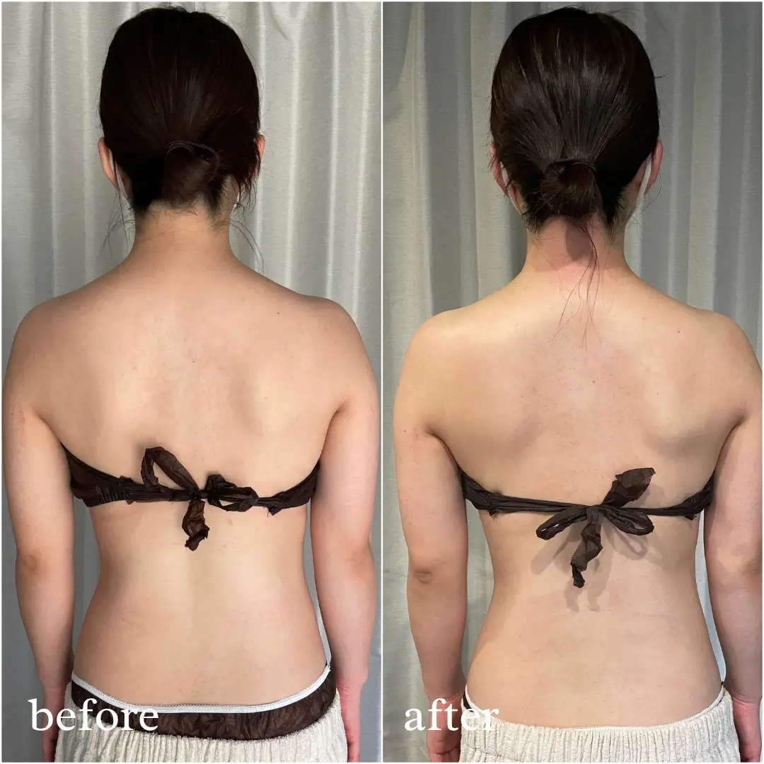 before/after写真_9