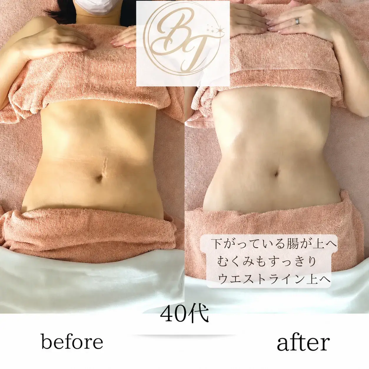 before/after写真_8