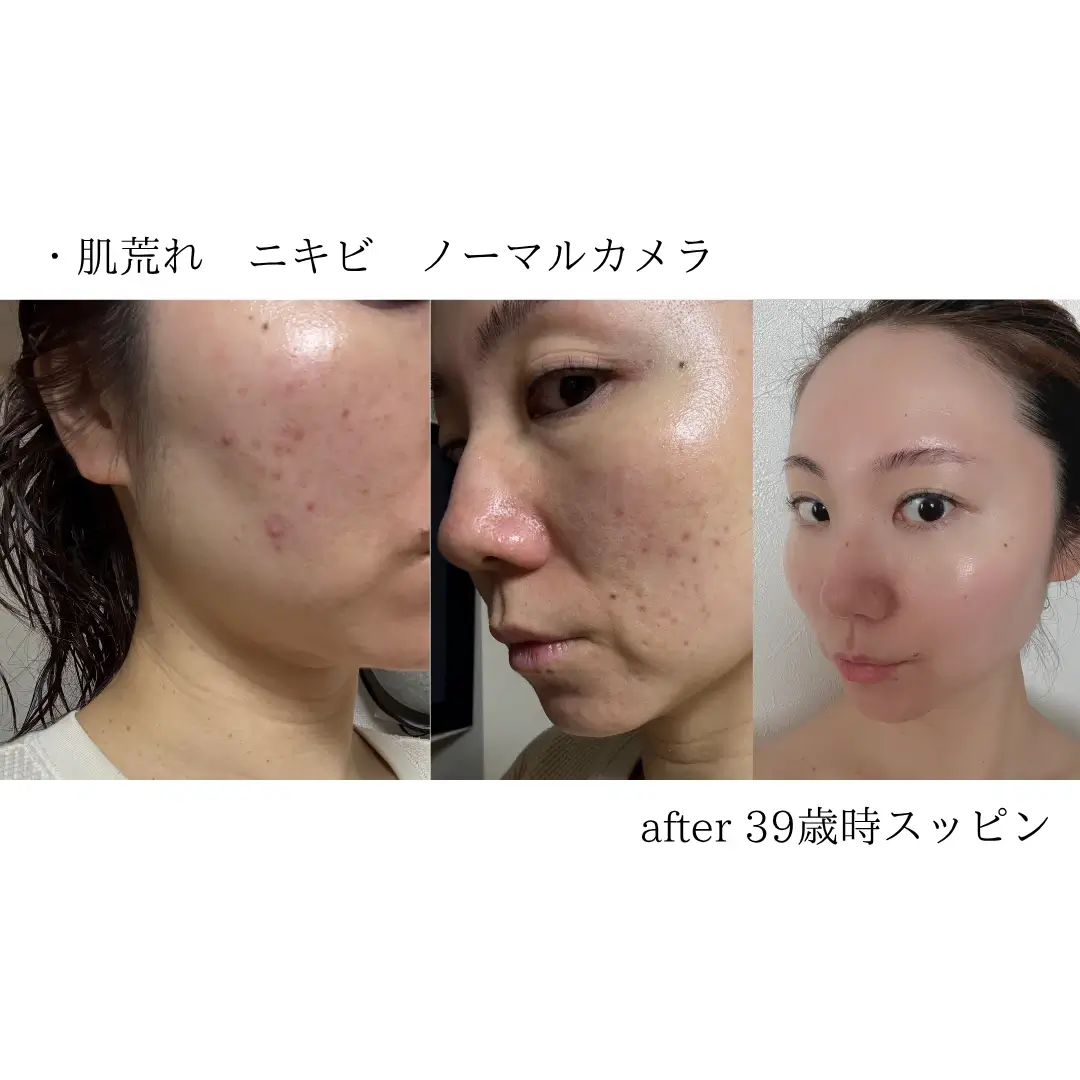 before/after写真_1