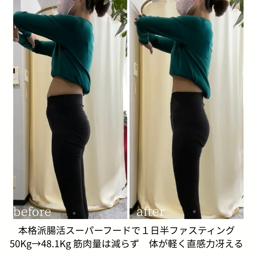 before/after写真_10