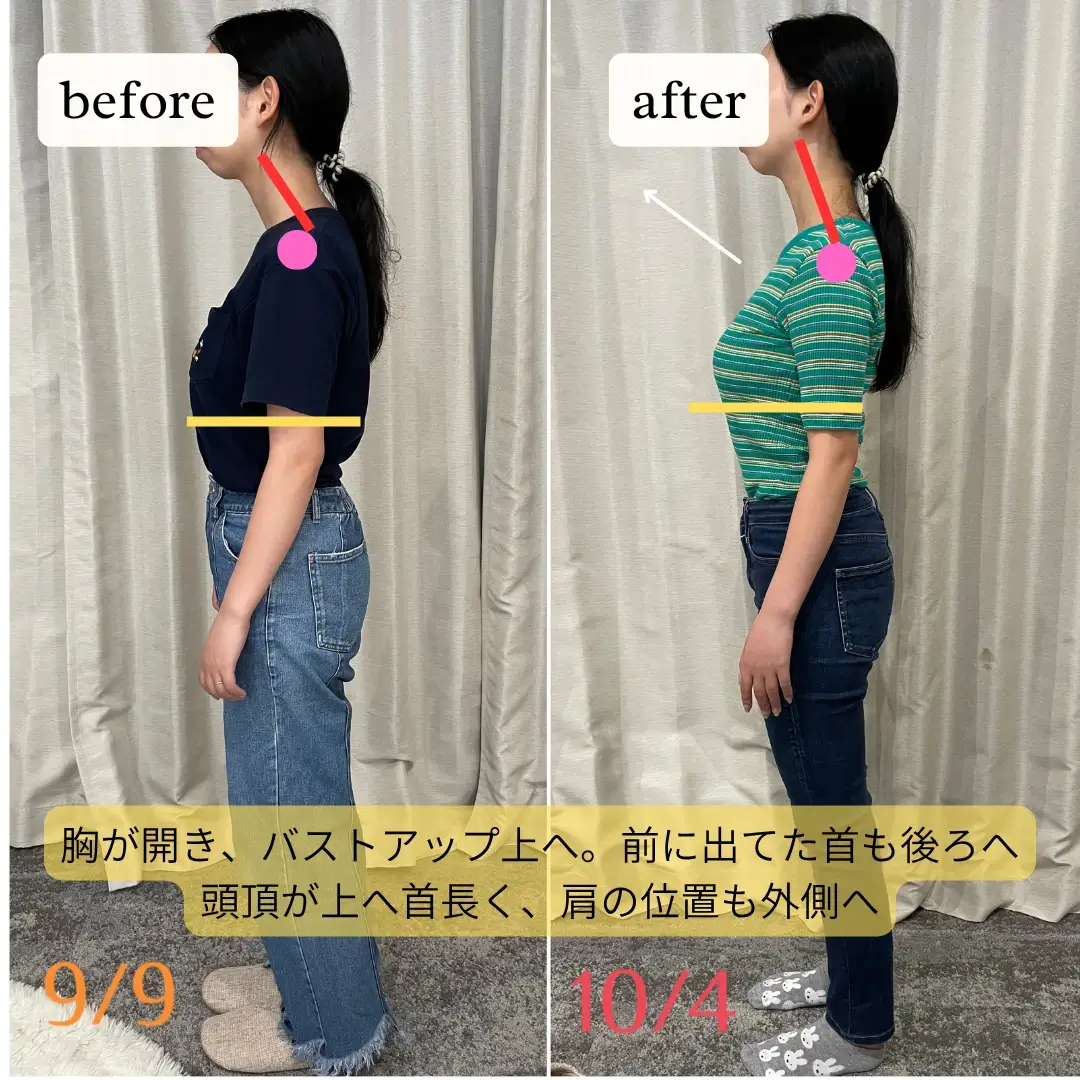 before/after写真_11