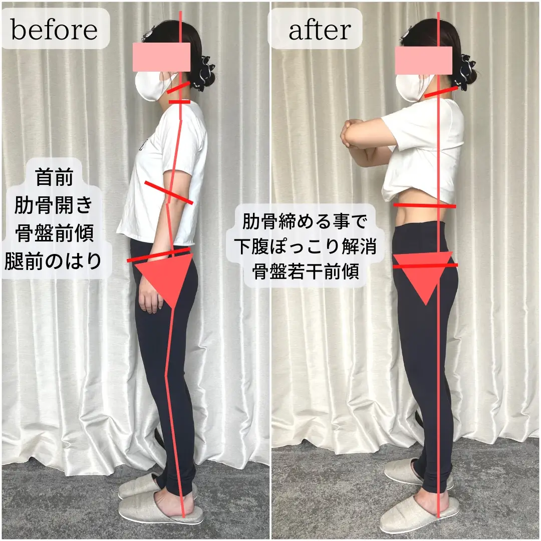 before/after写真_12