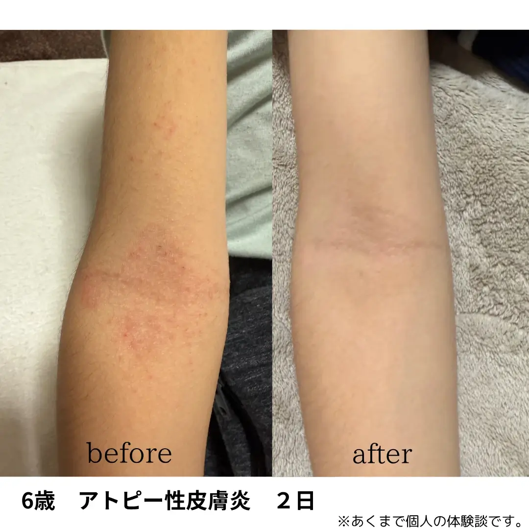 before/after写真_13